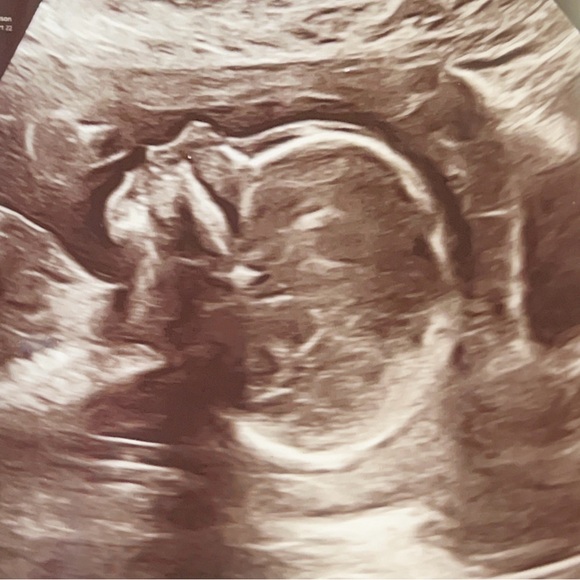 Meet your Posher, Isabella - Picture 5 of 5